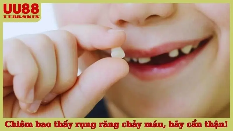 Chiêm bao thấy rụng răng chảy máu, hãy cẩn thận!