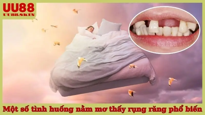 Một số tình huống nằm mơ thấy rụng răng phổ biến
