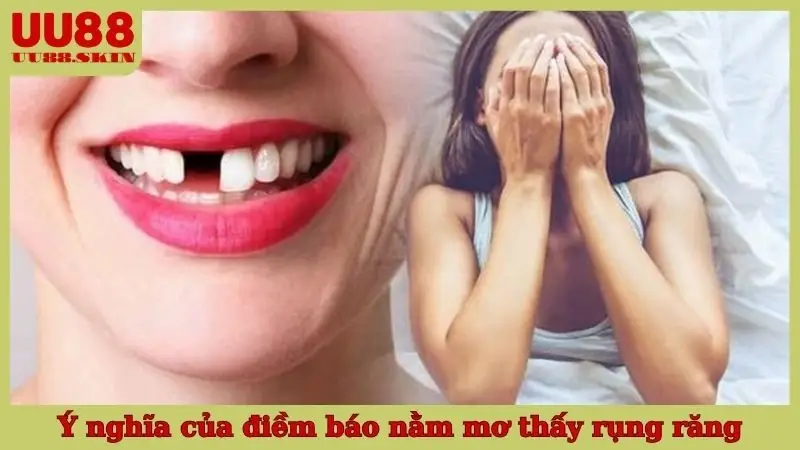 Ý nghĩa của điềm báo nằm mơ thấy rụng răng